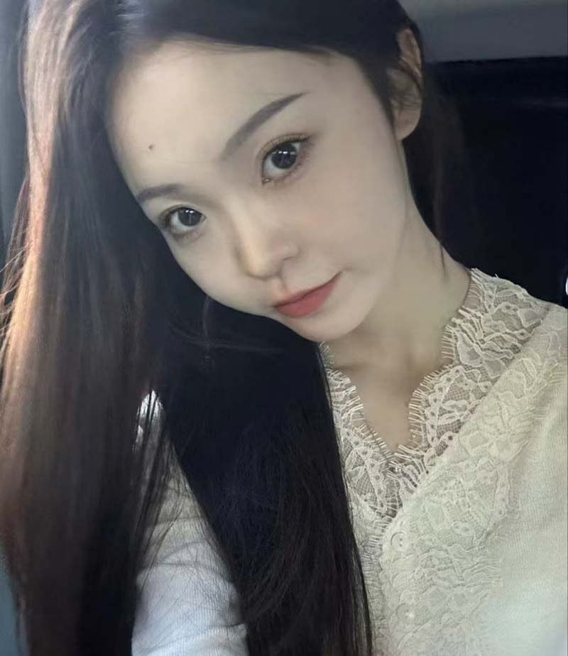 20251110172948914 img 20251110 172436 327